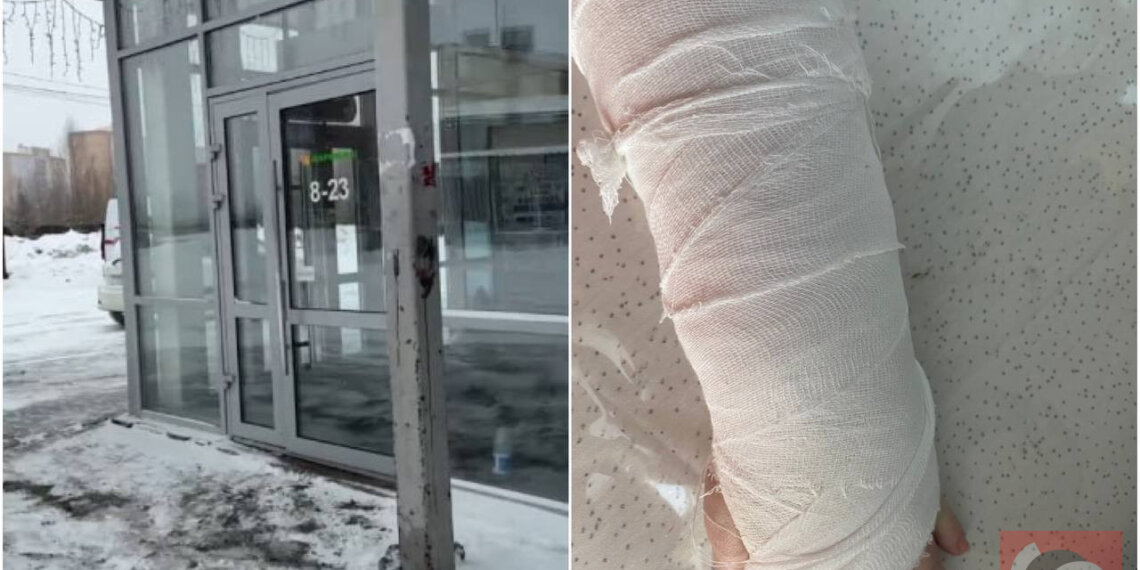 Новосибирский супермаркет предложил женщине «копеечную» компенсацию за сломанную руку