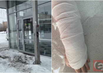 Новосибирский супермаркет предложил женщине «копеечную» компенсацию за сломанную руку
