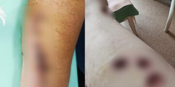 В Новосибирске семья год не может добиться наказания для нападавших