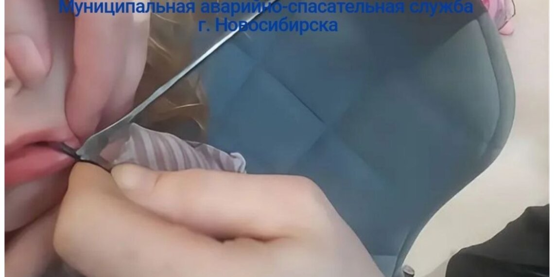 В Новосибирске малыш застрял языком в спицах зонта