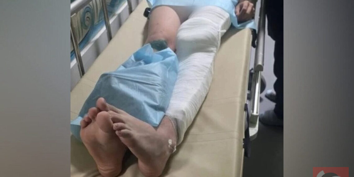 14-летний питбайкер сломал ногу в драке с двумя новосибирцами