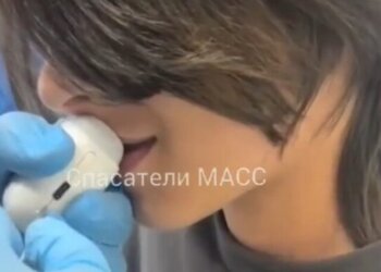 В Новосибирске спасатели освободили губу 12-летнего мальчика от машинки для стрижки ногтей